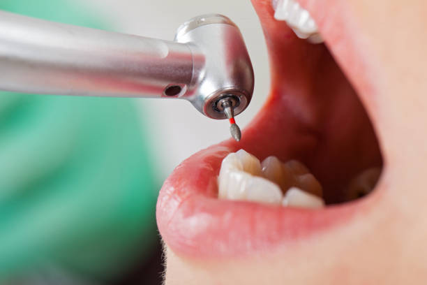 Best Emergency Tooth Extraction in St Lawrence, PA